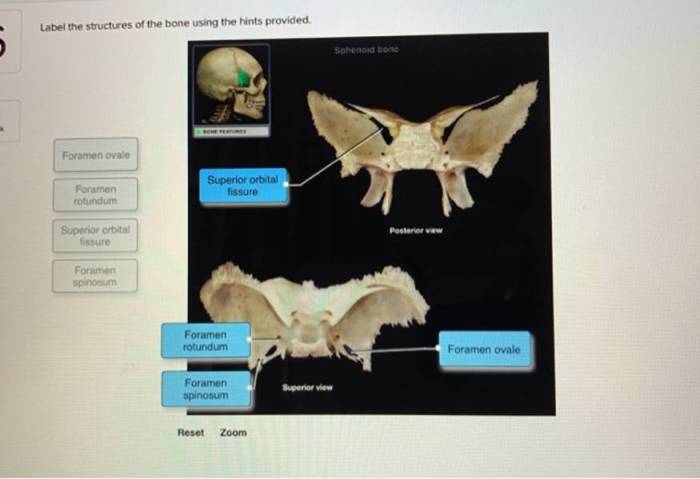 Label the female perineum using the hints provided