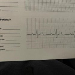 Part b practice interpreting electrocardiograms answers