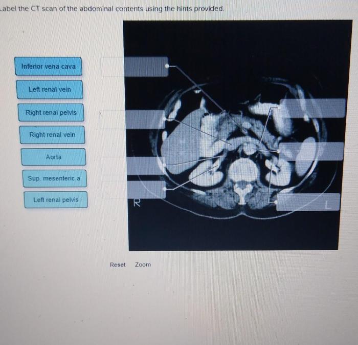 Label the female perineum using the hints provided